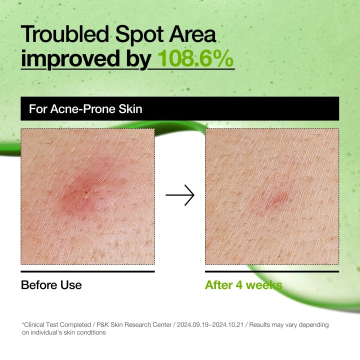 Azelaic Acid 10 Hyaluron Redness Soothing Serum | ANUA