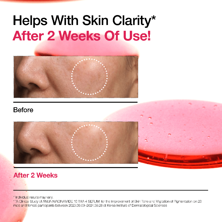 Niacinamide 10 TXA 4 Sérum Anti-Taches | ANUA