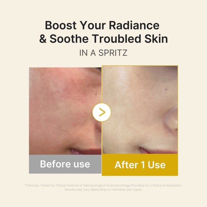 MEDICUBE Vitamin Gold Gelée Brume Sérum | K-Star