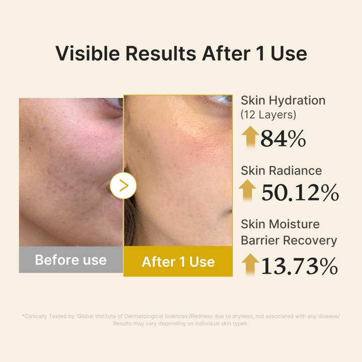 MEDICUBE Vitamin Gold Gelée Brume Sérum | K-Star