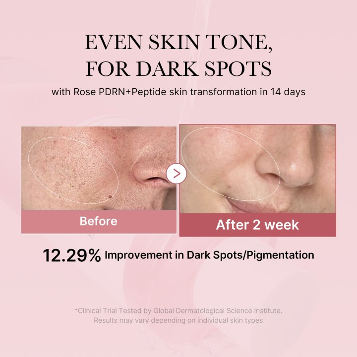 MEDICUBE PDRN Pink Peptide Tonique | K-Star