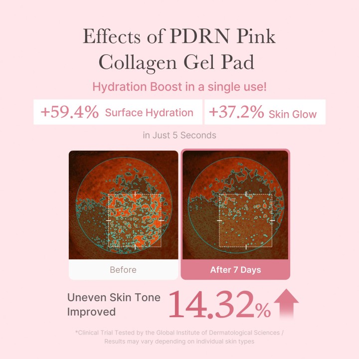 MEDICUBE PDRN Pink Collagen Gel Disque Tonique | K-Star