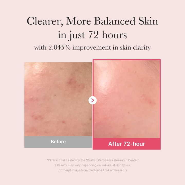 MEDICUBE TXA Niacinamide Sérum | K-Star