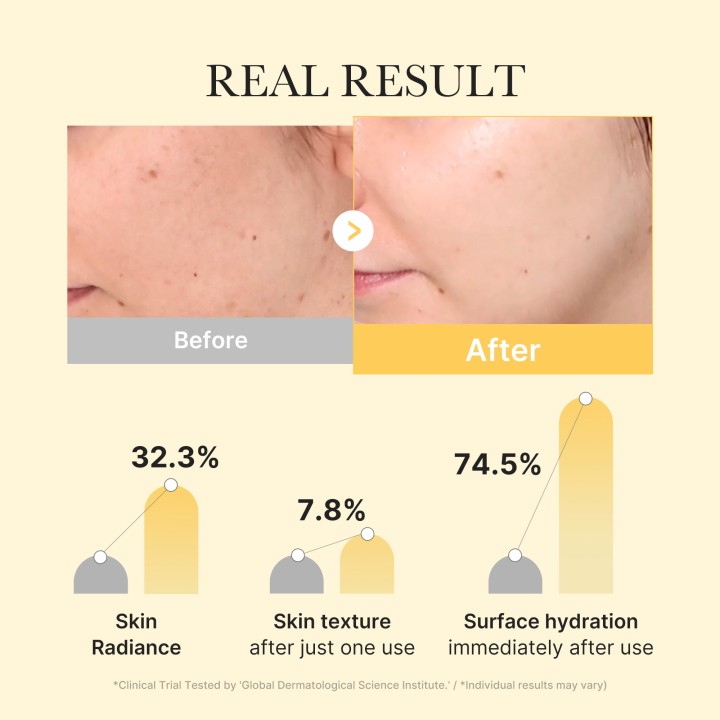 MEDICUBE Kojic Acid Turmeric Gold Gel Masque | K-Star