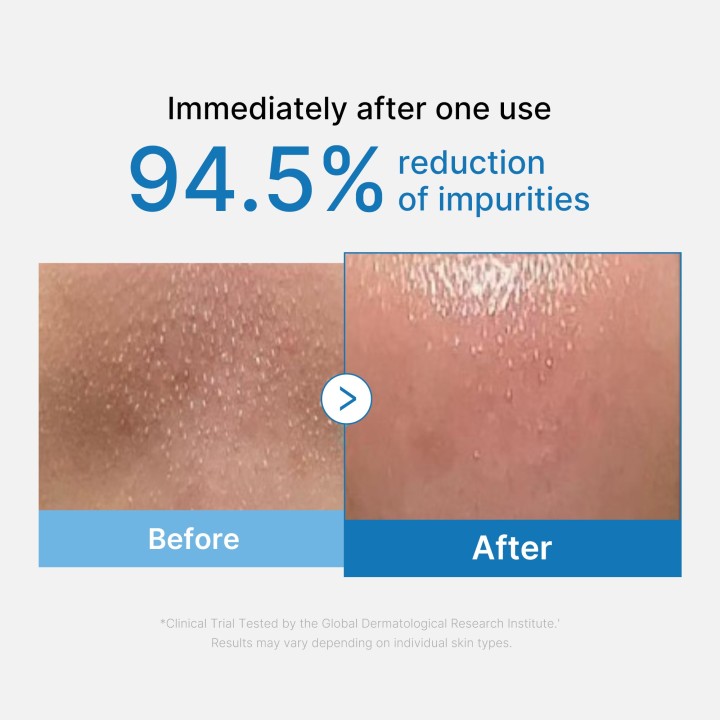 MEDICUBE Zero Pore Blackhead Huile Démaquillante | K-Star