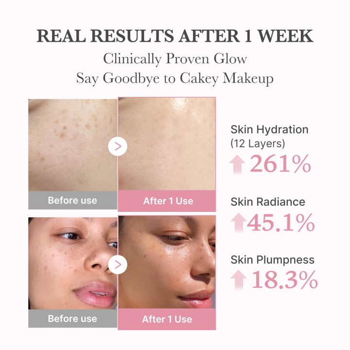 MEDICUBE PDRN Pink Collagen Bubble Sérum | K-Star