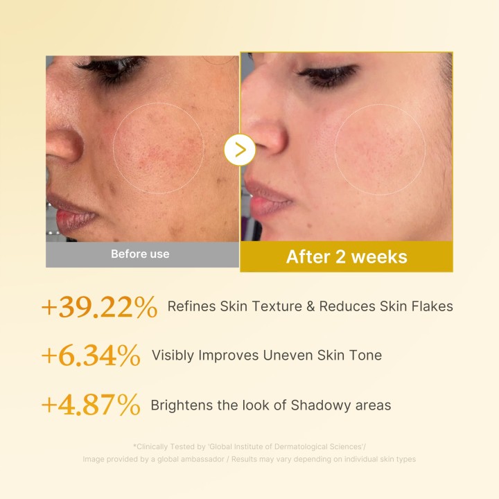 MEDICUBE Kojic Acid Turmeric Tonique | K-Star