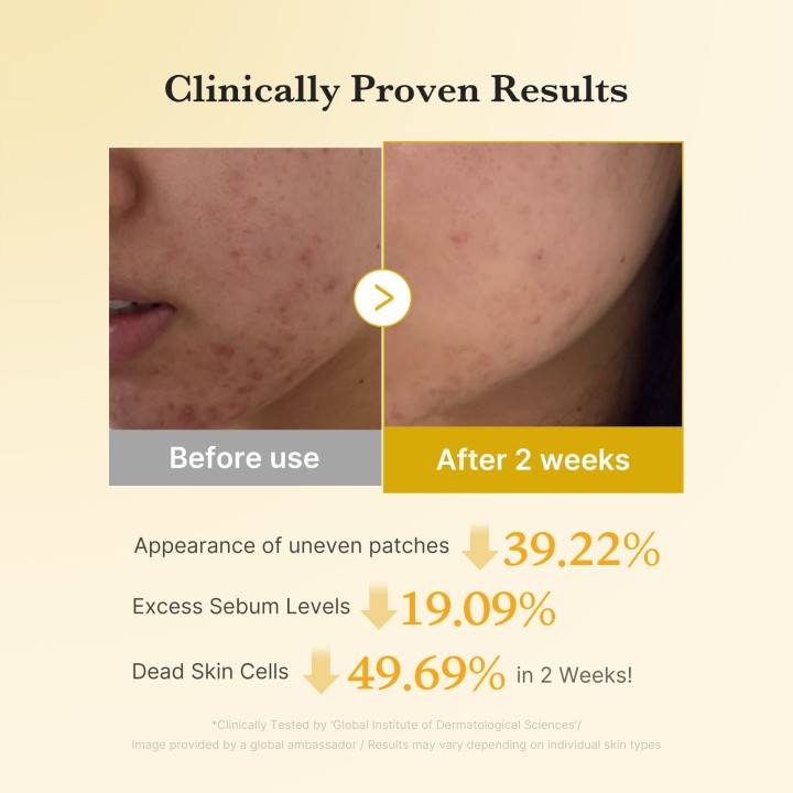 MEDICUBE Kojic Acid Turmeric Disque Tonique | K-Star